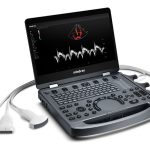 Mindray Portable USG (MX6) – Ultrasound | Sysmark Bangladesh