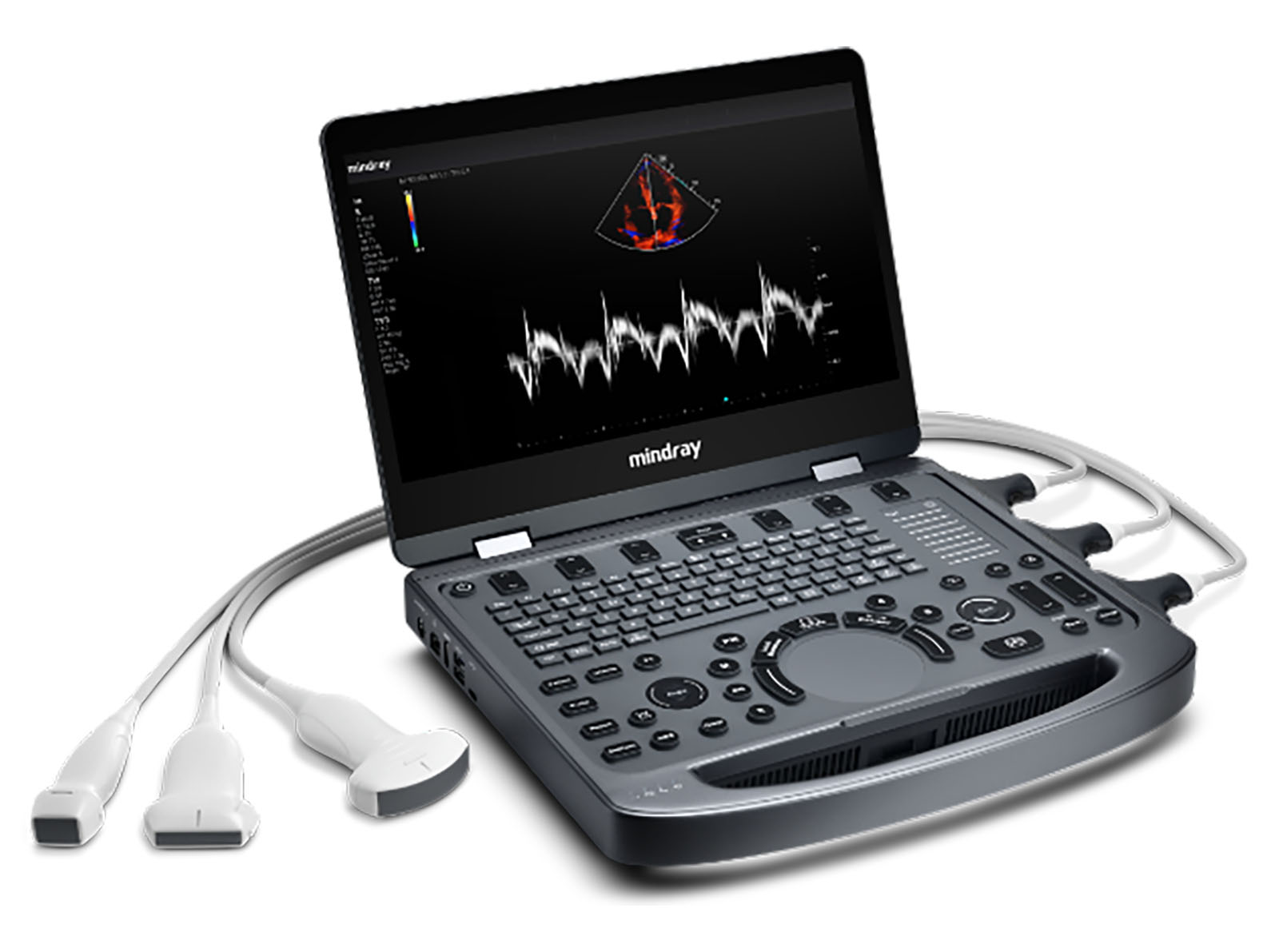 Mindray Portable USG (MX6) – Ultrasound | Sysmark Bangladesh