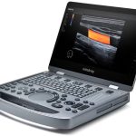 Mindray Portable USG (MX3) – Ultrasound | Sysmark Bangladesh