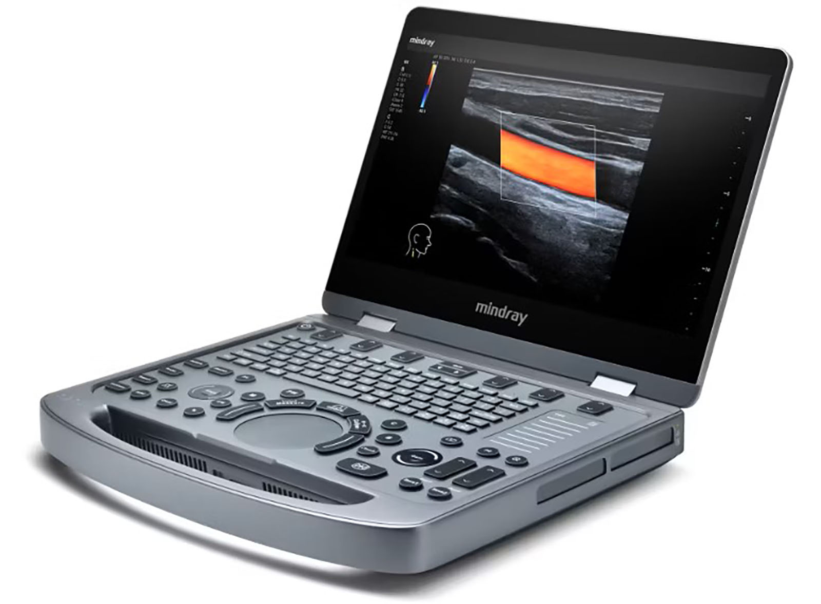 Mindray Portable USG (MX3) – Ultrasound | Sysmark Bangladesh